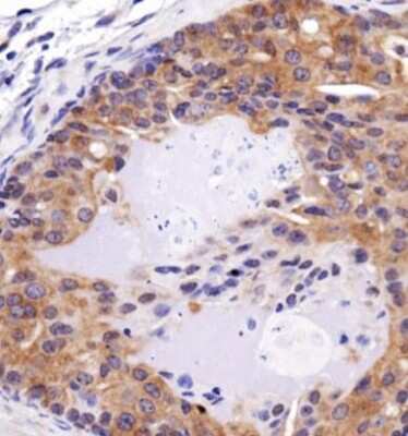 Immunohistochemistry: FAT4 Antibody - BSA Free [NBP1-78381]