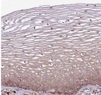 Immunohistochemistry-Paraffin: FAT4 Antibody [NBP2-49064]