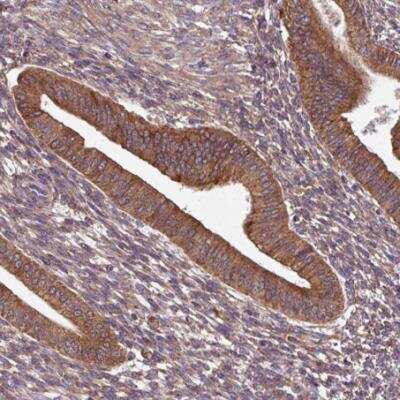 Immunohistochemistry-Paraffin: FAT4 Antibody [NBP2-49064]