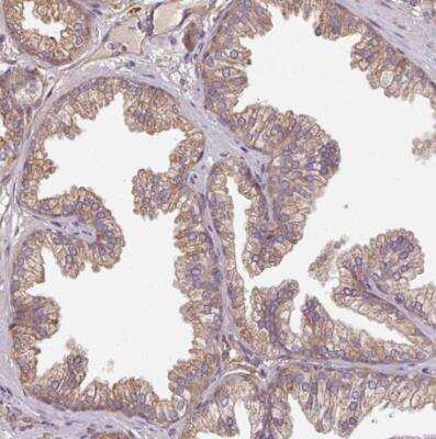 Immunohistochemistry-Paraffin: FAT4 Antibody [NBP2-49064]