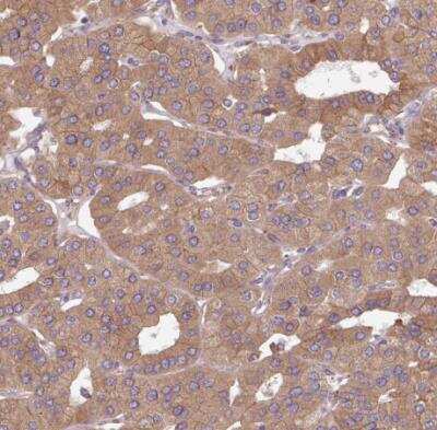 Immunohistochemistry-Paraffin: FAT4 Antibody [NBP2-49064]