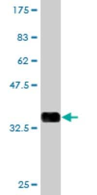 Western Blot: FATE1 Antibody (1B11) [H00089885-M06]