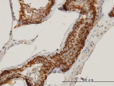 Immunohistochemistry-Paraffin: FATE1 Antibody (3B1) [H00089885-M08]