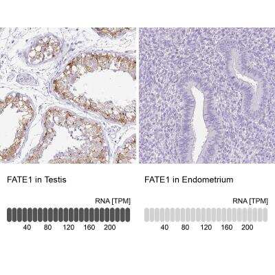 Immunohistochemistry-Paraffin: FATE1 Antibody [NBP1-85402]