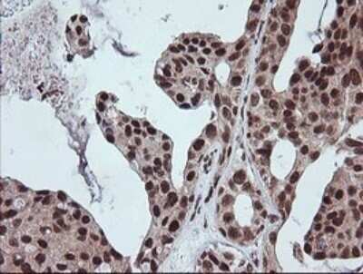 Immunohistochemistry: FATE1 Antibody (OTI1A1) - Azide and BSA Free [NBP2-72310]