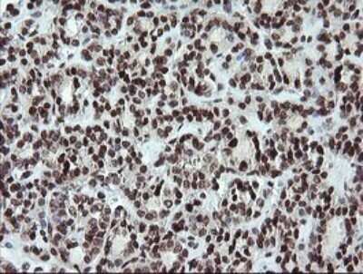 Immunohistochemistry: FATE1 Antibody (OTI1A1) - Azide and BSA Free [NBP2-72310]