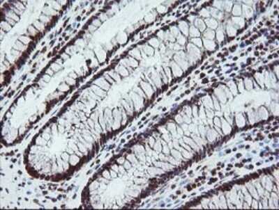 Immunohistochemistry: FATE1 Antibody (OTI1A1) - Azide and BSA Free [NBP2-72310]