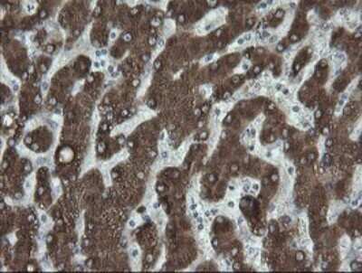 Immunohistochemistry: FATE1 Antibody (OTI1A1) - Azide and BSA Free [NBP2-72310]