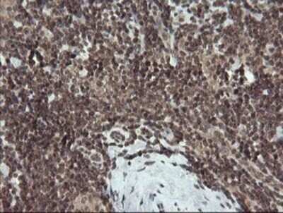 Immunohistochemistry: FATE1 Antibody (OTI1A1) - Azide and BSA Free [NBP2-72310]