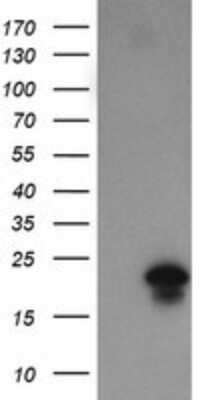 Western Blot: FATE1 Antibody (OTI1A1)Azide and BSA Free [NBP2-72310]