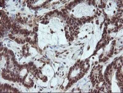 Immunohistochemistry: FATE1 Antibody (OTI1A1) [NBP2-45594]