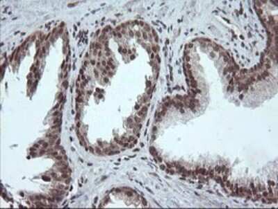 Immunohistochemistry: FATE1 Antibody (OTI1A1) [NBP2-45594]