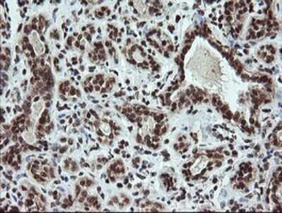 Immunohistochemistry: FATE1 Antibody (OTI1A1) [NBP2-45594]