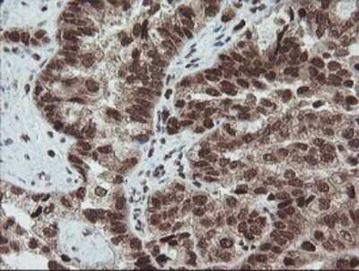 Immunohistochemistry: FATE1 Antibody (OTI1A1) [NBP2-45594]