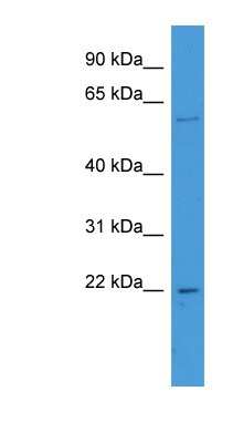 Western Blot: FATE1 Antibody [NBP1-79779]