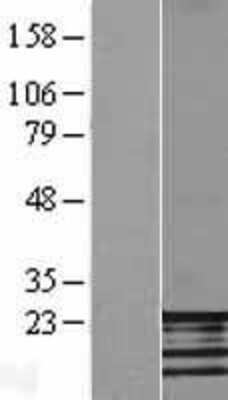 Western Blot: FATE1 Overexpression Lysate [NBL1-10605]