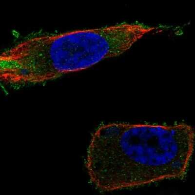 Immunocytochemistry/ Immunofluorescence: FATP1/SLC27A1 Antibody [NBP2-69016]