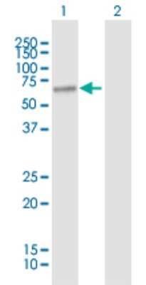 Western Blot: FATP1/SLC27A1 Antibody [H00376497-B01P]