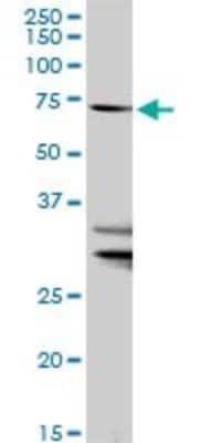 Western Blot: FATP1/SLC27A1 Antibody [H00376497-D01P]