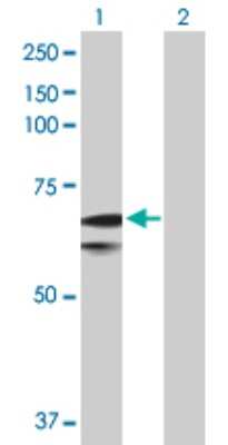 Western Blot: FATP1/SLC27A1 Antibody [H00376497-D01P]