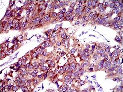 Immunohistochemistry-Paraffin: FATP2/SLC27A2 Antibody (6B3A9) - BSA Free [NBP2-37738]