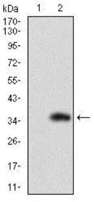 Western Blot: FATP2/SLC27A2 Antibody (6B3A9)BSA Free [NBP2-37738]