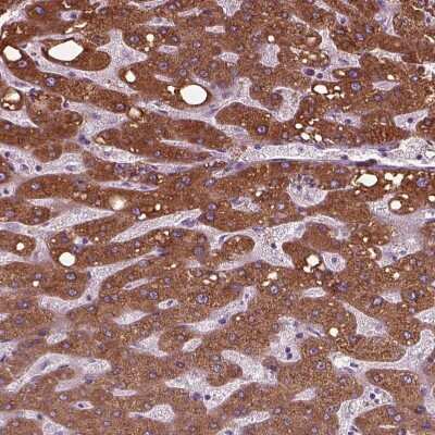 Immunohistochemistry-Paraffin: FATP2/SLC27A2 Antibody [NBP3-05516]