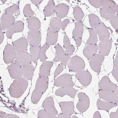 Immunohistochemistry-Paraffin: FATP2/SLC27A2 Antibody [NBP3-05516]