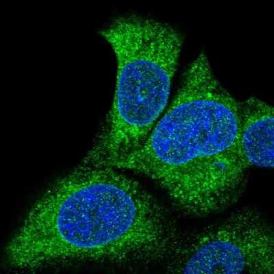 Immunocytochemistry/ Immunofluorescence: FATP3/SLC27A3 Antibody [NBP2-57049]