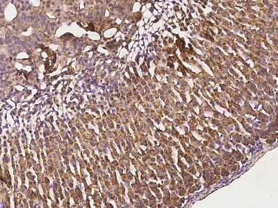 Immunohistochemistry-Paraffin: FATP3/SLC27A3 Antibody [NBP2-99424]