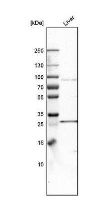 Western Blot: FATP3/SLC27A3 Antibody [NBP1-89265]