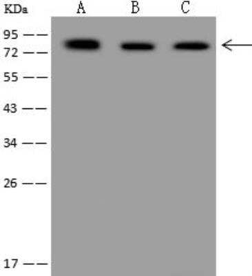 Western Blot: FATP3/SLC27A3 Antibody [NBP3-12706]