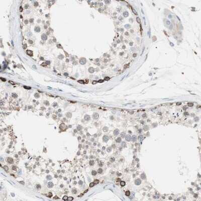 Immunohistochemistry-Paraffin: FATP4/SLC27A4 Antibody [NBP3-05510]