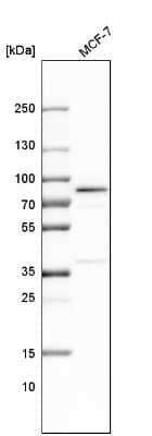 Western Blot: FATP4/SLC27A4 Antibody [NBP3-05510]