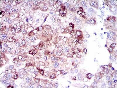 Immunohistochemistry: FATP5/SLC27A5 Antibody (4B11C10) - BSA Free [NBP2-37413]
