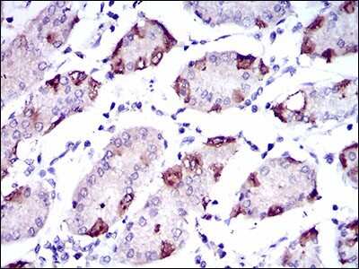 Immunohistochemistry: FATP5/SLC27A5 Antibody (4B11C10) - BSA Free [NBP2-37413]