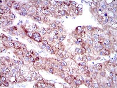 Immunohistochemistry-Paraffin: FATP5/SLC27A5 Antibody (9C4D1) - BSA Free [NBP2-37412]