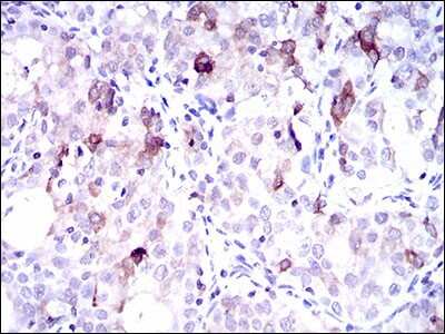 Immunohistochemistry-Paraffin: FATP5/SLC27A5 Antibody (9C4D1) - BSA Free [NBP2-37412]