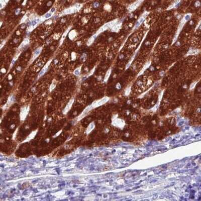 Immunohistochemistry-Paraffin: FATP5/SLC27A5 Antibody (CL0213) [NBP2-14788]
