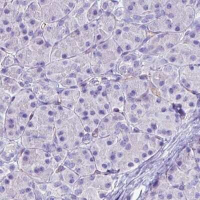 Immunohistochemistry-Paraffin: FATP5/SLC27A5 Antibody (CL0213) [NBP2-14788]