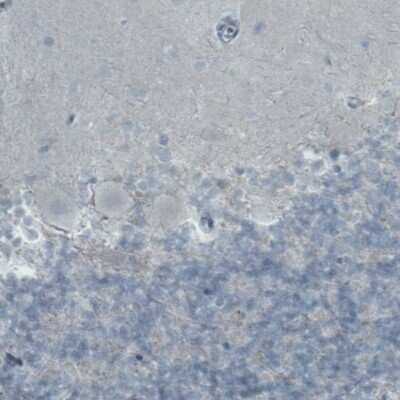 Immunohistochemistry-Paraffin: FATP5/SLC27A5 Antibody (CL0215) [NBP2-52880]