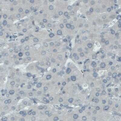 Immunohistochemistry-Paraffin: FATP5/SLC27A5 Antibody (CL0215) [NBP2-52880]
