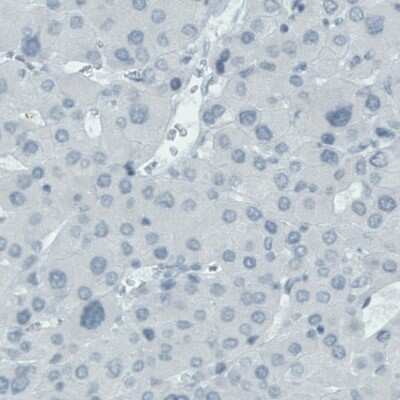 Immunohistochemistry-Paraffin: FATP5/SLC27A5 Antibody (CL0216) [NBP2-52881]