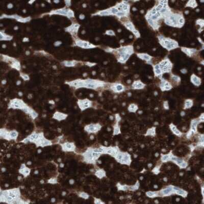 Immunohistochemistry-Paraffin: FATP5/SLC27A5 Antibody (CL0216) [NBP2-52881]