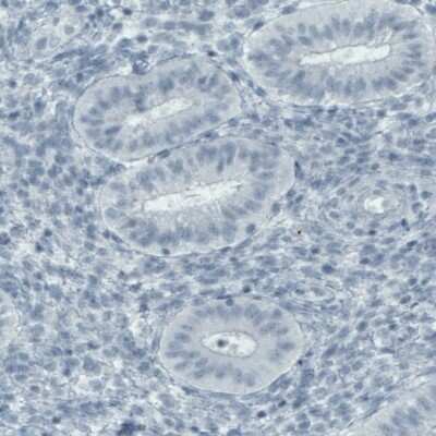 Immunohistochemistry-Paraffin: FATP5/SLC27A5 Antibody (CL0216) [NBP2-52881]