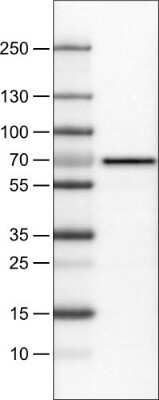 Western Blot: FATP5/SLC27A5 Antibody (CL0216) [NBP2-52881]