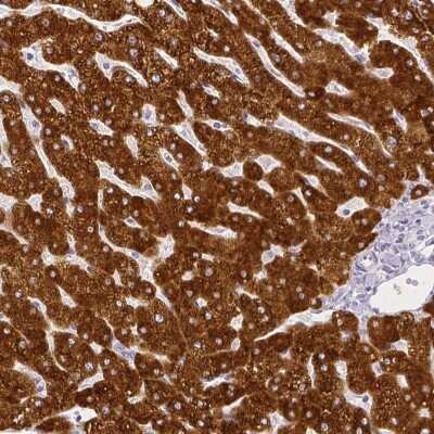 Immunohistochemistry-Paraffin: FATP5/SLC27A5 Antibody [NBP1-89267]