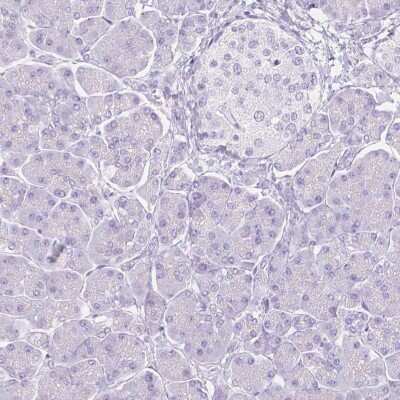 Immunohistochemistry-Paraffin: FATP5/SLC27A5 Antibody [NBP1-89267]