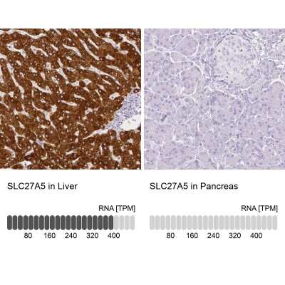 Immunohistochemistry-Paraffin: FATP5/SLC27A5 Antibody [NBP1-89267]