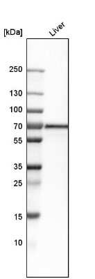 Western Blot: FATP5/SLC27A5 Antibody [NBP1-89267]
